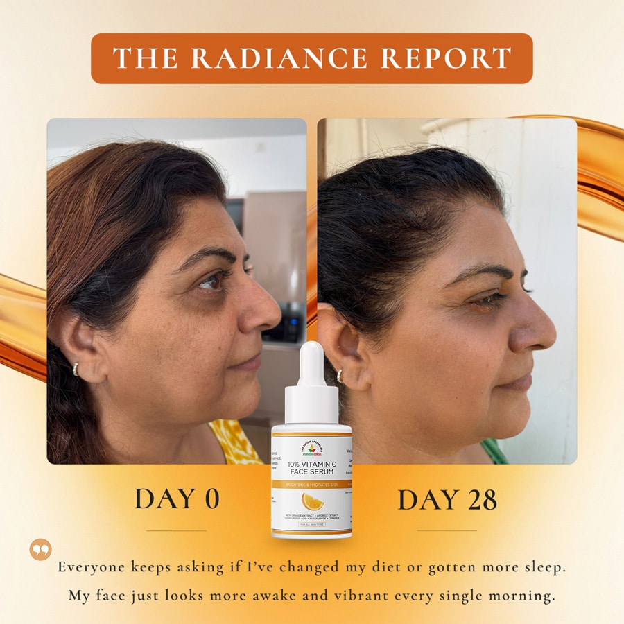10 Percent Vitamin C Face Serum Before and After Transformation Day 0 to 28 Radiance Report The Serum Specialists